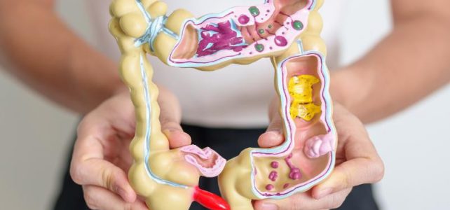 Minuto Intestino Saudável: ICS faz orientações aos servidores sobre câncer colorretal